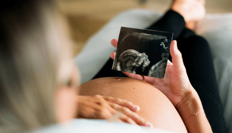 Pregnant woman holding an ultrasound picture next to pregnant belly (C-section anxiety)