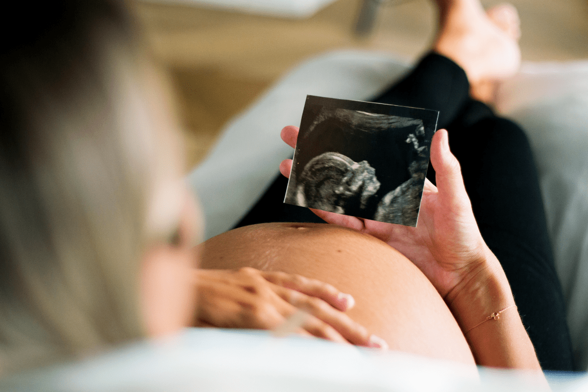 Pregnant woman holding an ultrasound picture next to pregnant belly (C-section anxiety)