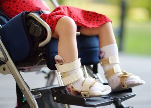 A child with leg braces- Talking to Your Kids About Disabilities