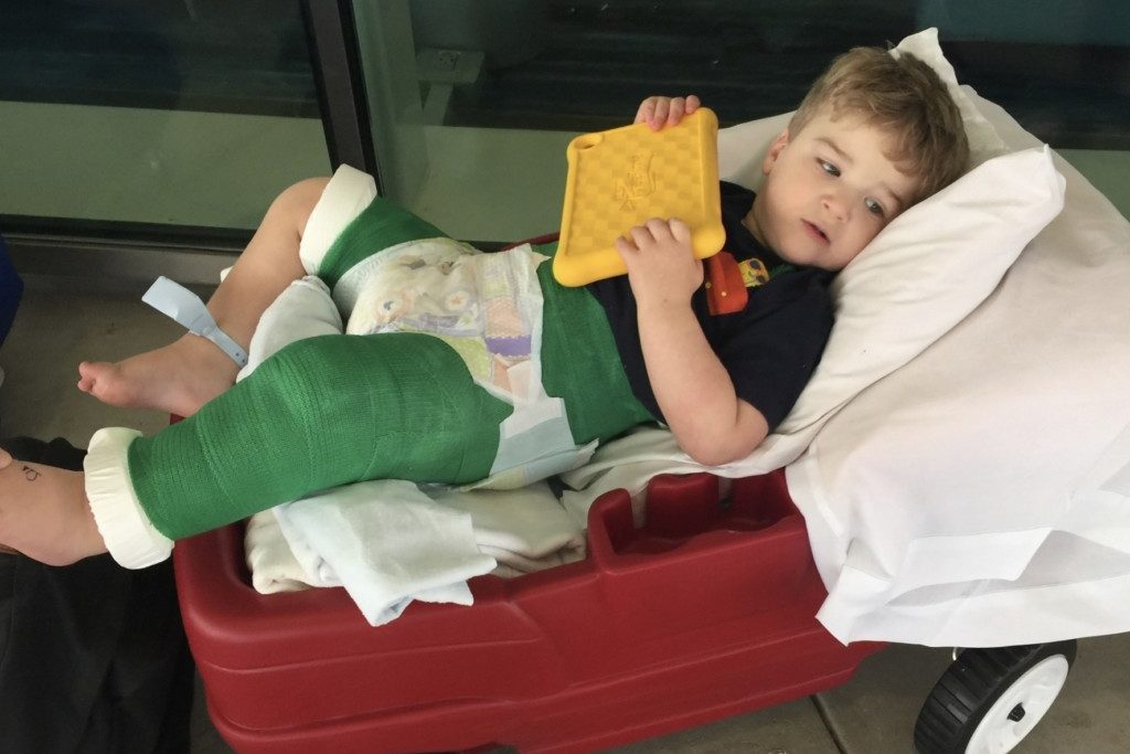 femur - Boston Moms Blog
